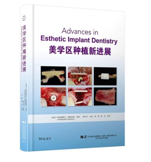 美学区种植新进展 商品图0