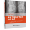 膝关节骨性关节炎的综合治疗 商品缩略图0