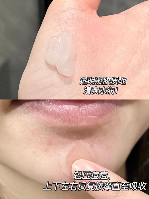 敷尔佳定海神针祛痘凝胶  控油淡化祛痘印痘坑修复粉刺闭口10g 商品图3