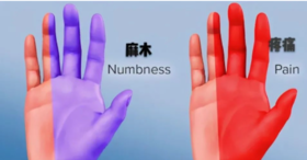  手指发麻预示着10种疾病！ 