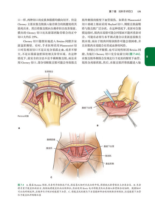 铁林迪妇科手术学 第12版 赵兴波等译 常见疾病诊断程序药物治疗手术操作流程 女性生殖器官生理解剖 人民卫生出版社9787117334815 商品图4