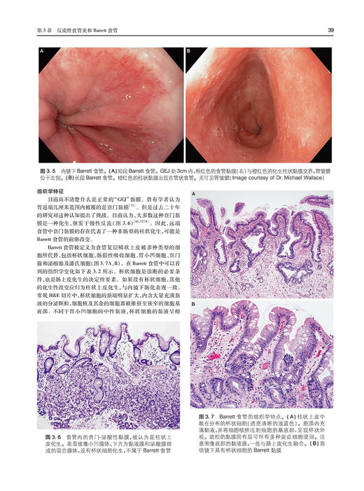 消化道非肿瘤性疾病外科病理学 姜支农 陈丹 王学菊主译 常见疾病临床特征病理特征鉴别诊断要点治疗 人民卫生出版社9787117345569 商品图3