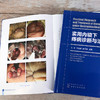 实用内镜下痔病诊断与治1疗 商品缩略图5
