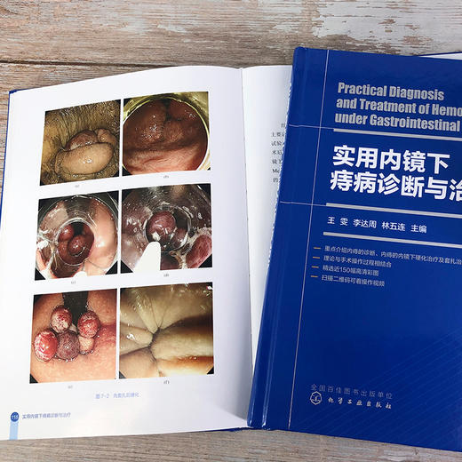 实用内镜下痔病诊断与治1疗 商品图5