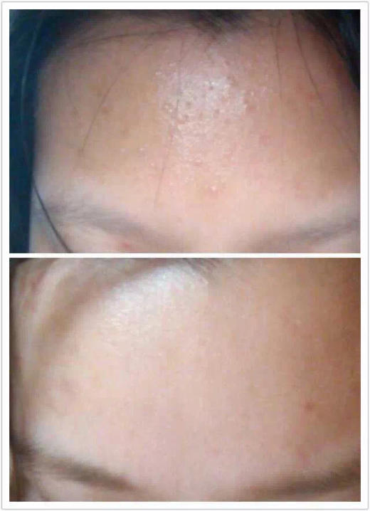 【十余年口碑，新年新鲜入库】A醇（视黄醇）弹力精华油  王炸精华 20ml 复刻媲美某顿金胶 晚上精华步骤 不加防腐剂 体系温和不刺激 油性肌肤不油 干性肌肤不干 商品图3