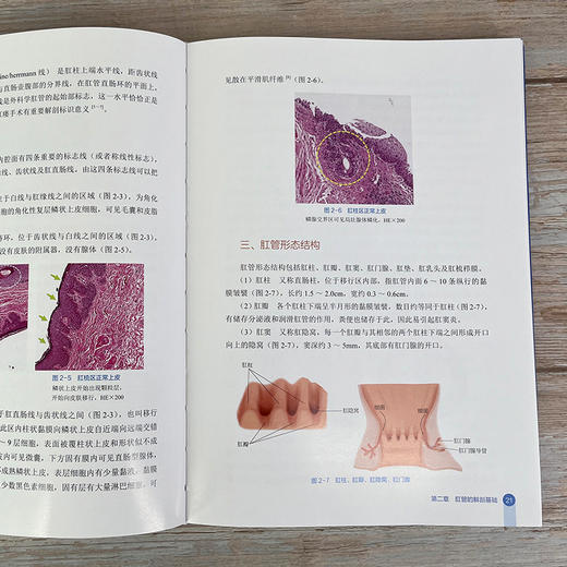 实用内镜下痔病诊断与治1疗 商品图10