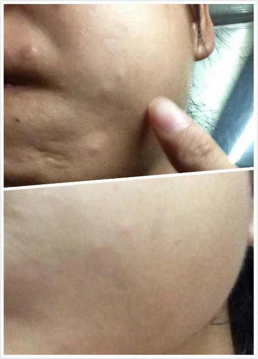 【十余年口碑，新年新鲜入库】A醇（视黄醇）弹力精华油  王炸精华 20ml 复刻媲美某顿金胶 晚上精华步骤 不加防腐剂 体系温和不刺激 油性肌肤不油 干性肌肤不干 商品图5