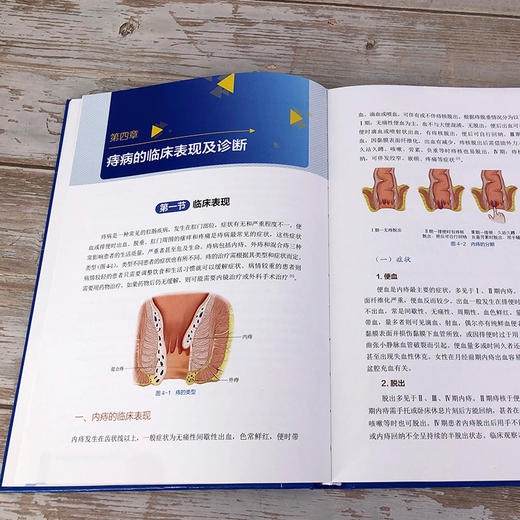 实用内镜下痔病诊断与治1疗 商品图7