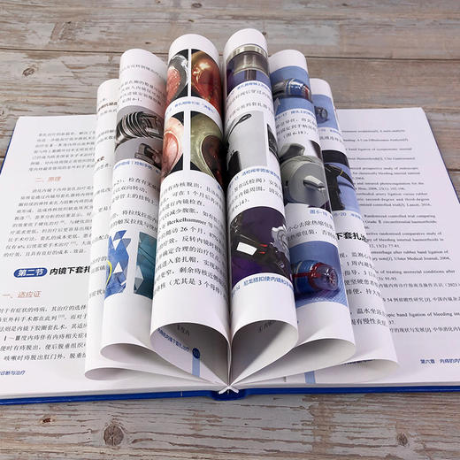 实用内镜下痔病诊断与治1疗 商品图6