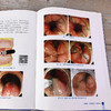 实用内镜下痔病诊断与治1疗 商品缩略图8