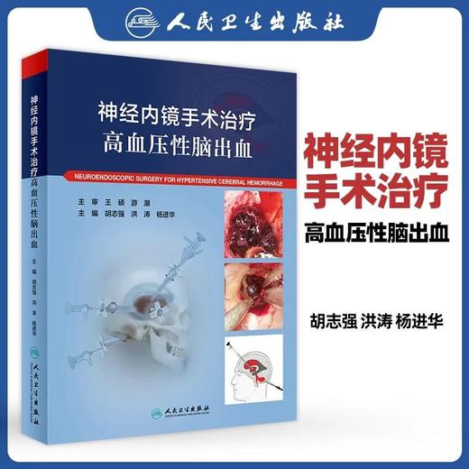 现货《神经内镜手术治疗高血压性脑出血》运费到付 商品图0