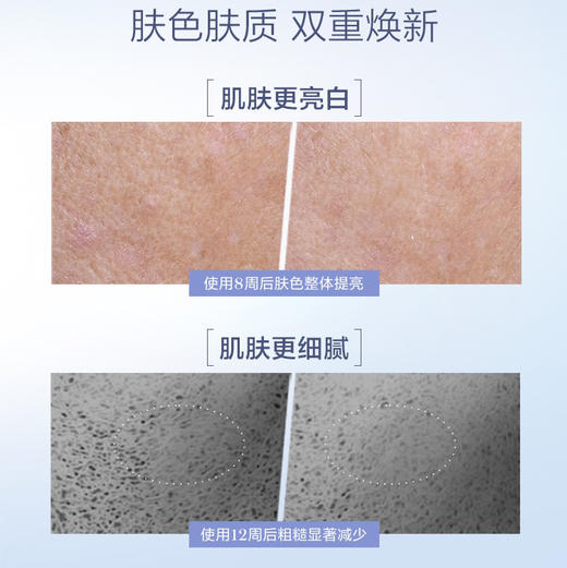 法国 LANCOME兰蔻 极光焕白精华 30ml/50ml 商品图4