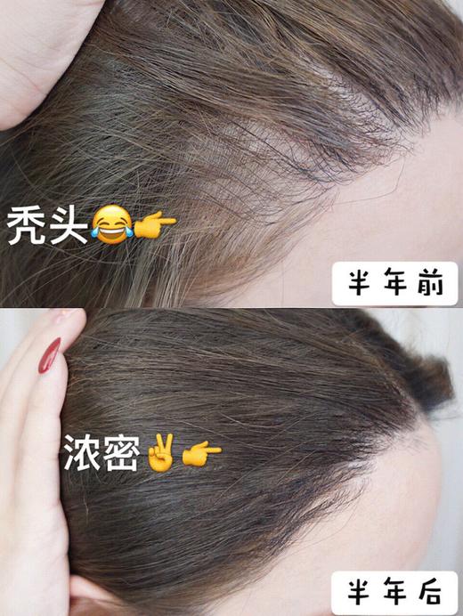 【清仓好价】西班牙sesderma头皮护理精华4ml*5/4ml*10 商品图3