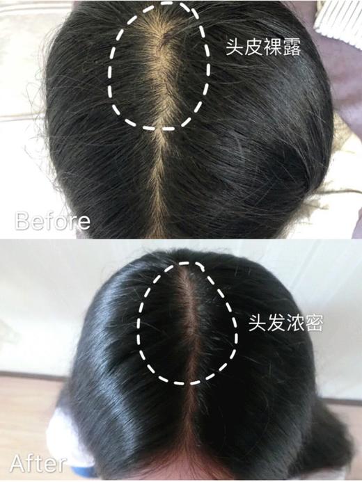 【清仓好价】西班牙sesderma头皮护理精华4ml*5/4ml*10 商品图2