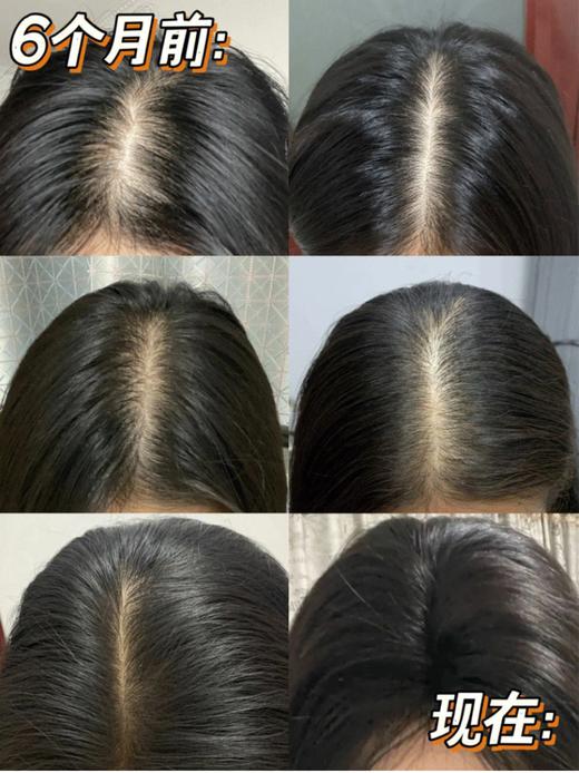 【清仓好价】西班牙sesderma头皮护理精华4ml*5/4ml*10 商品图5