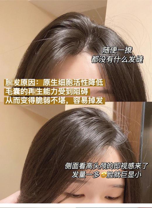 【清仓好价】西班牙sesderma头皮护理精华4ml*5/4ml*10 商品图4