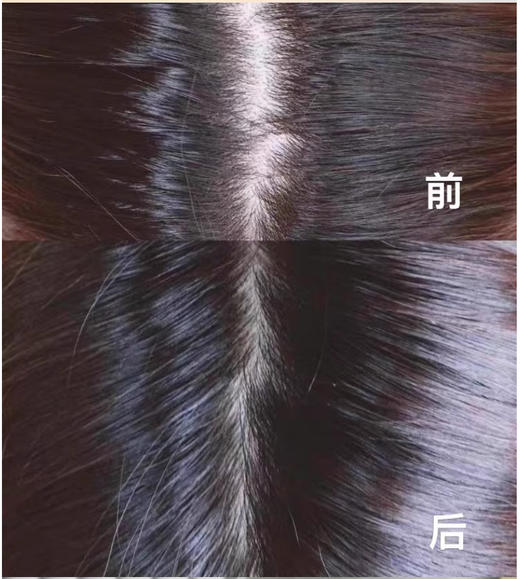 【清仓好价】意大利丰添防脱生发育发安瓶精华液100ml（男用）（效期至23.11） 商品图4