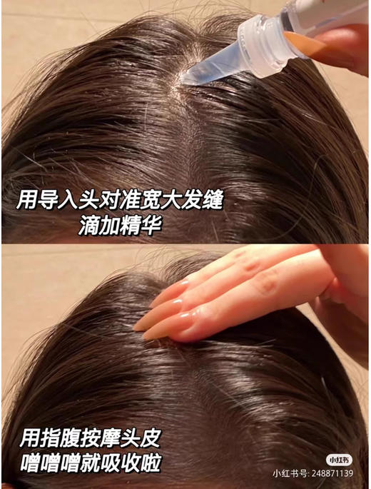 【清仓好价】意大利丰添防脱生发育发安瓶精华液100ml（男用）（效期至23.11） 商品图2