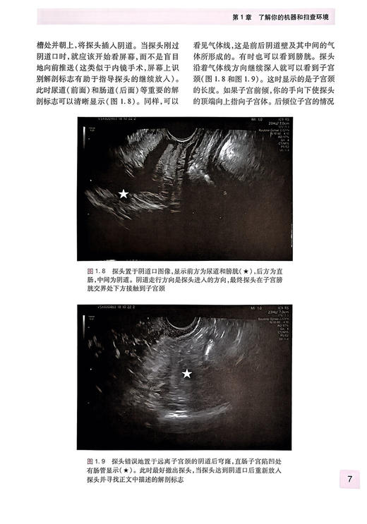 妇科超声检查要点与技巧 黄瑛主译 妇科超声先进技术超声设备报告书写 超声扫查技术疾病诊断 影像学 人民卫生出版社9787117347372 商品图4