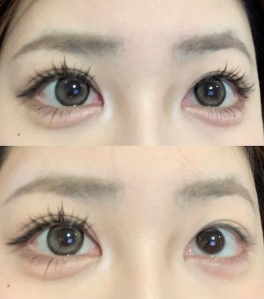 大直径推荐丨月光石·Doriscon丨14.5mm（年抛/2片装） 商品图3