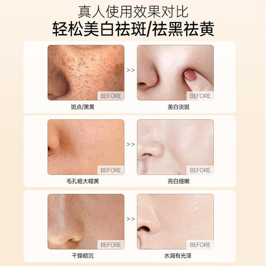 儒意维莲芙水光复颜10片 提亮美白 去黄亮白 烟酰胺补水保湿舒缓 | 儒意官方商城 商品图1