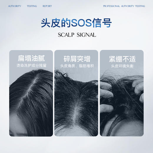 SIYI头皮净澈去屑啫喱100g 商品图1