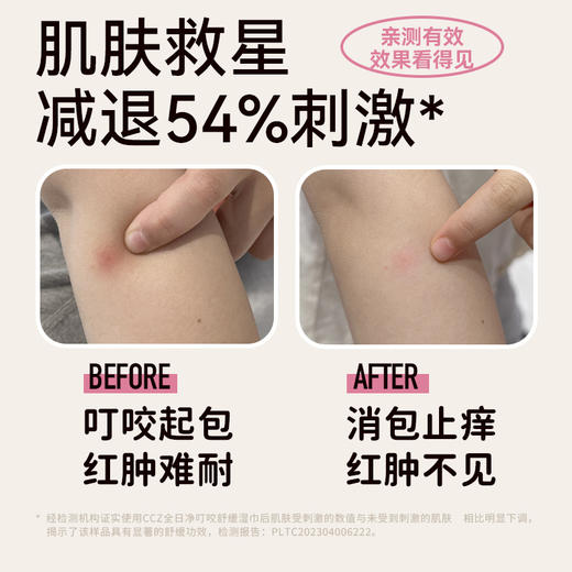 CCZ全日净止痒舒缓湿巾孕妇宝宝户外蚊子蚊虫叮咬止痒修护 商品图4