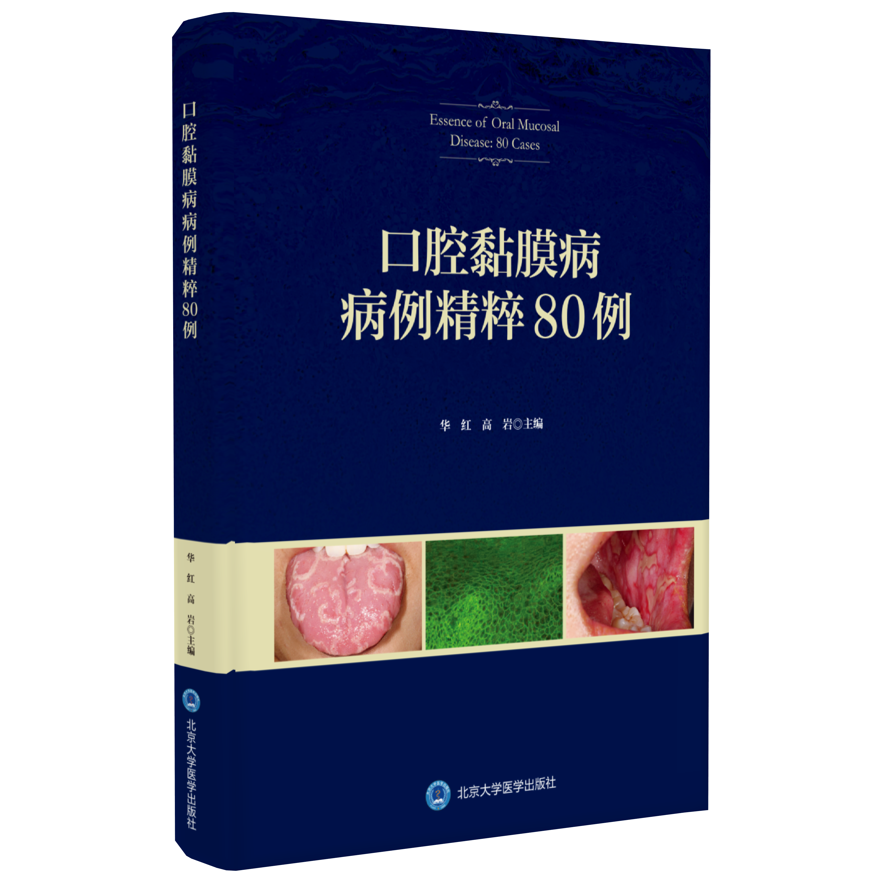 口腔黏膜病病例精粹80例 华红 高岩 主编 北医社