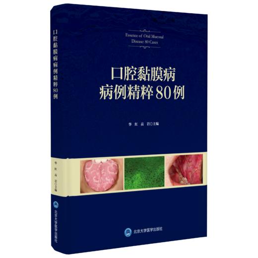 口腔黏膜病病例精粹80例 华红 高岩 主编 北医社 商品图0