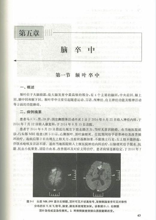 正版现货 神经康复病例分析 全国高等学校康复医学培训教材 范建中主编 人民卫生出版社 神经医学书籍 临床医学书籍 商品图3