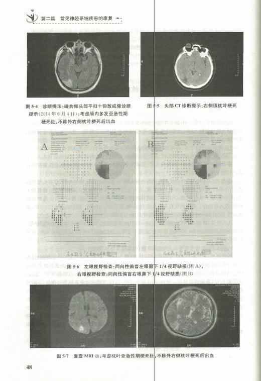 正版现货 神经康复病例分析 全国高等学校康复医学培训教材 范建中主编 人民卫生出版社 神经医学书籍 临床医学书籍 商品图1