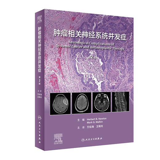 肿瘤相关神经系统并发症（第2版） 2023年5月参考书 9787117347471 商品图0