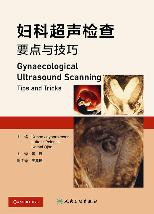 妇科超声检查要点与技巧 2023年5月参考书 9787117347372 商品图1