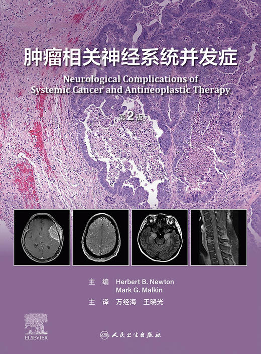 肿瘤相关神经系统并发症（第2版） 2023年5月参考书 9787117347471 商品图1