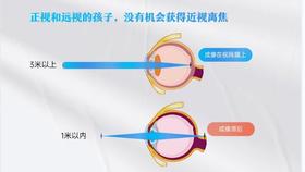 如何制造成像超前