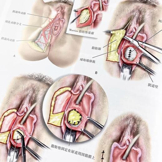 精装新版盆腔解剖与妇产科手术图谱下卷 中文翻译版原书第5版 盆腔解剖学与妇产科手术学相关外科手术学结合从局部解剖到手术步骤 商品图3