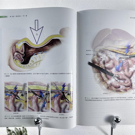 新版精装盆腔解剖与妇产科手术图谱中卷 原书第5版解剖图谱手术医学实用妇产科学妇科医学书内镜检查与内镜手术妇产科主治医师用书 商品图3