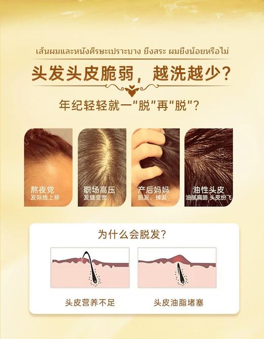 泰国进口ATREUS生姜洗发水控油止痒去屑防脱发400ml 商品图3