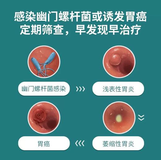 C13胃幽门螺旋杆菌呼气检测 商品图2