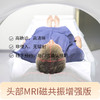 【爱康君安】头部MRI磁共振筛查增强版 VIP尊享 高清晰 非侵入 商品缩略图0