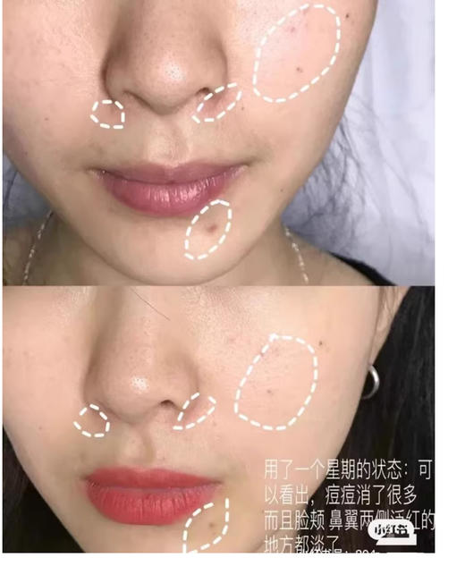 【清仓好价】依泉舒缓修复爽肤水250ml（效期至23.10） 商品图4