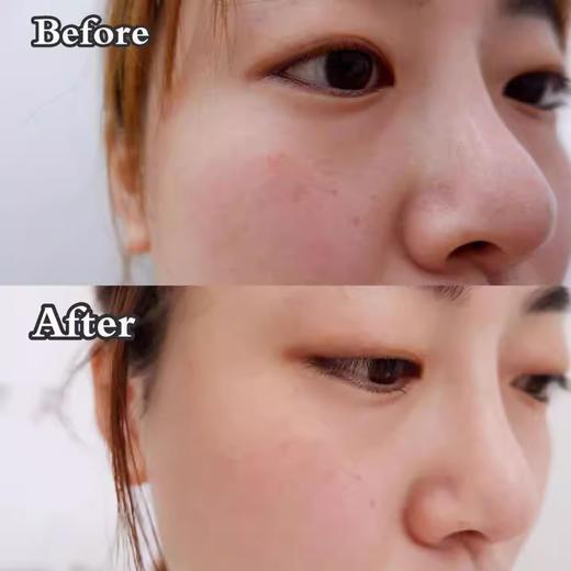 【清仓好价】妮维雅辅酶Q10面膜 20片 商品图3