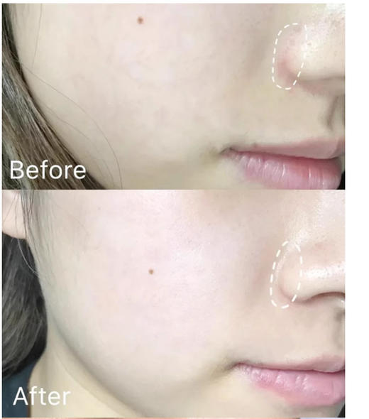 【清仓好价】依泉舒缓修复爽肤水250ml（效期至23.10） 商品图3