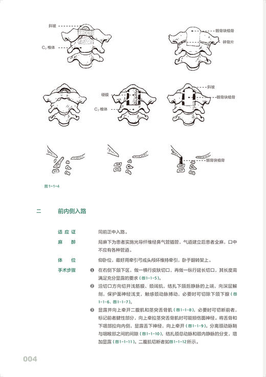 骨科手绘手术图谱 精准手绘+操作视频+要点注释 路磊等编 手术操作步骤解读指导 身体各部位手术入路 围手术期介绍 人民卫生出版社 商品图3