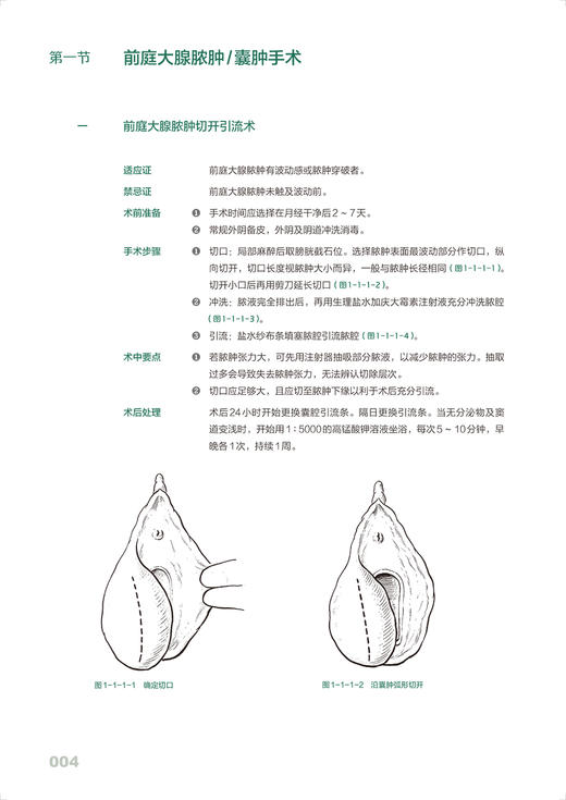 妇产科手绘手术图谱 精准手绘+操作视频+要点注释 徐国成 孟祥凯孟涛 临床手绘手术图谱丛书 常规手术操作步骤讲解 人民卫生出版社 商品图3