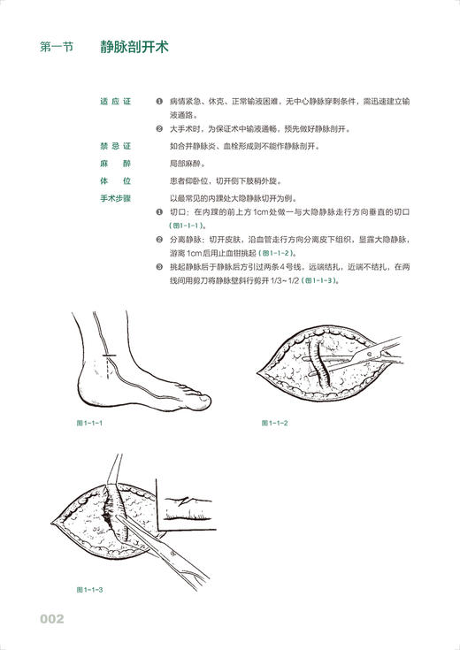 普通外科手绘手术图谱 精准手绘+操作视频+要点注释 徐国成 罗英伟 韩秋生 外科常规手术经典手术术式正规操作方法 人民卫生出版社 商品图3