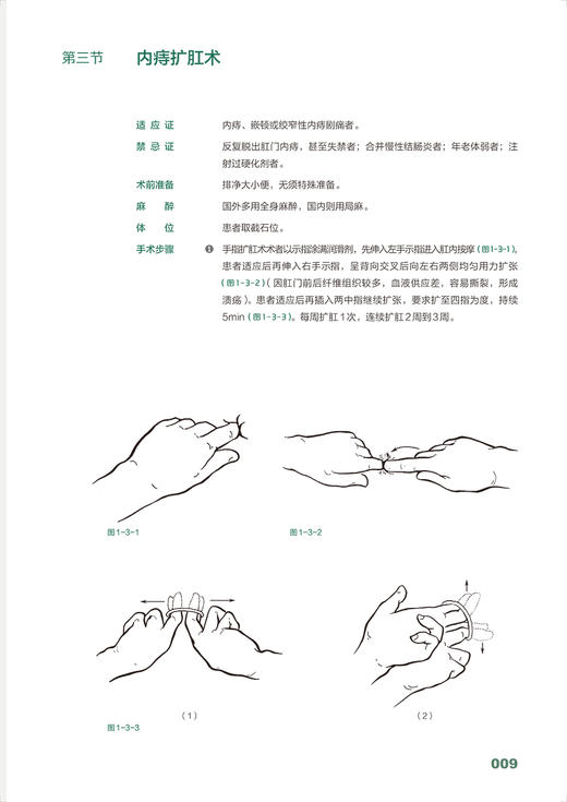 肛肠外科手绘手术图谱 精准手绘+操作视频+要点注释 徐国成 李春雨 临床手绘手术图谱丛书 常规和微创手术操作讲解 人民卫生出版社 商品图3