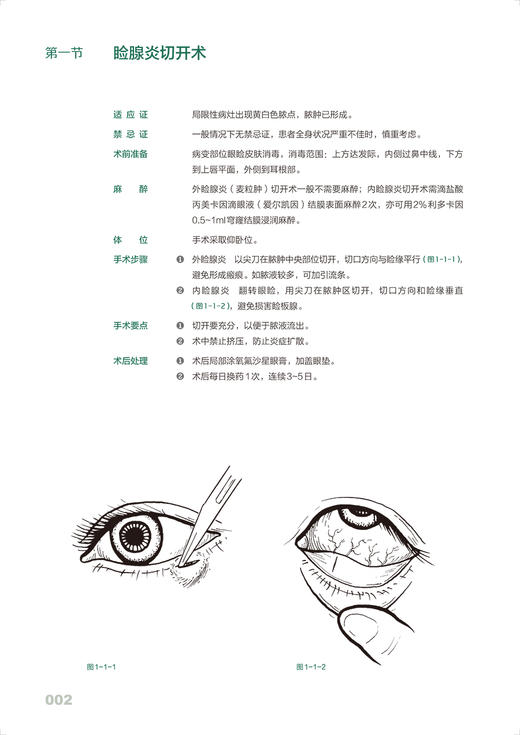 眼科手绘手术图谱 精准手绘+操作视频+要点注释 韩秋生 临床手绘手术图谱丛书 临床常规眼科手术方法步骤操作技巧 人民卫生出版社 商品图3