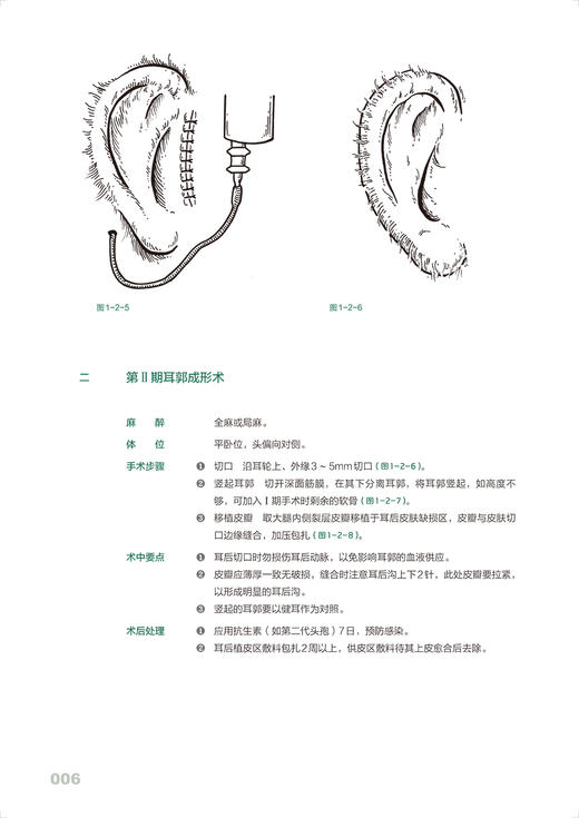 耳鼻咽喉科手绘手术图谱 精准手绘+操作视频+要点注释 韩秋生等编 临床手绘手术图谱丛书 常规手术操作步骤讲解 人民卫生出版社 商品图3