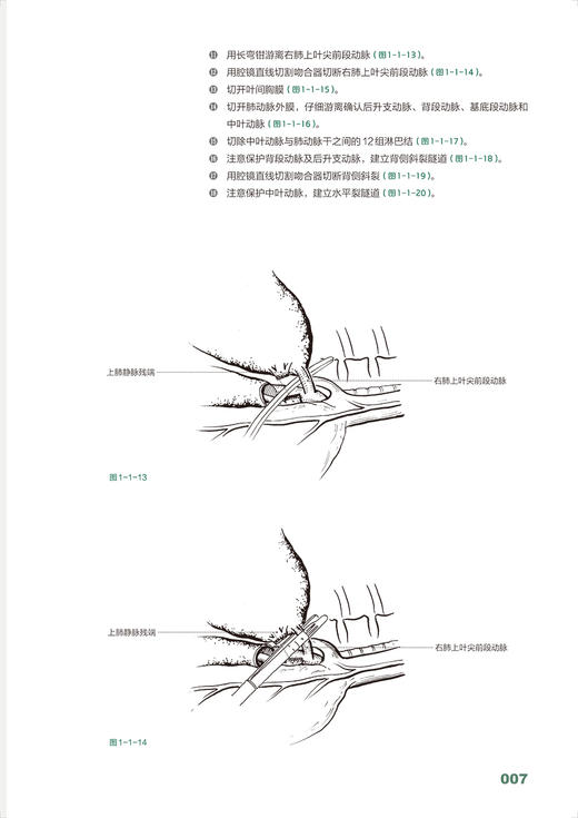 胸外科手绘手术图谱 精准手绘+操作视频+要点注释 徐国成等编 临床手绘手术图谱丛书 常见肿瘤相关胸腔镜手术操作 人民卫生出版社 商品图3